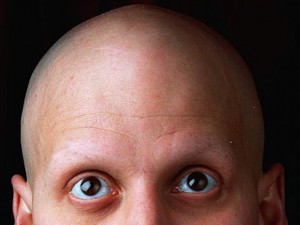 Bald Image