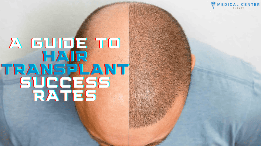 أفضل طبيب زراعة شعر