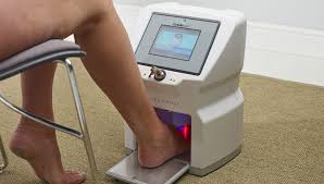 Onychomycosis