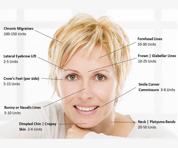 botox face