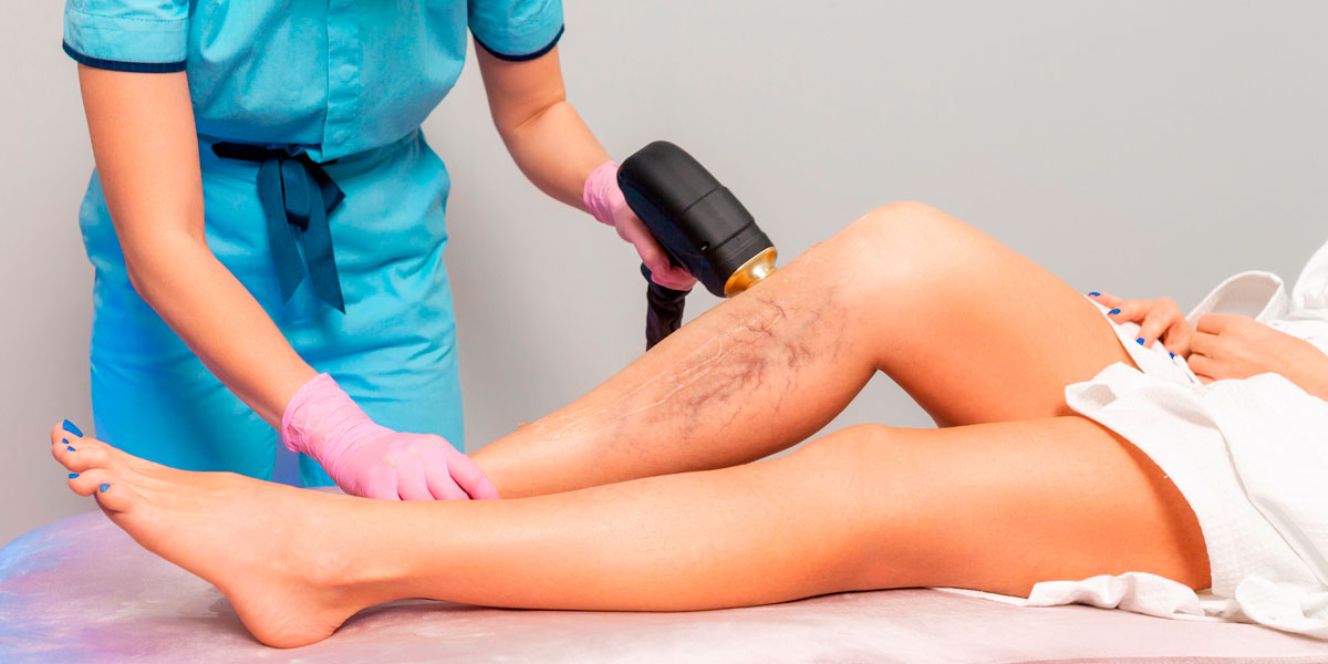 vascular laser
