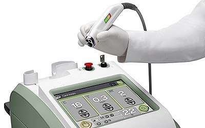 NdYAG Laser Treatment