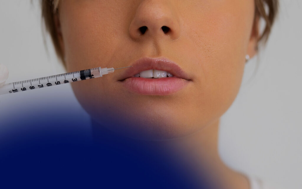 Scandinavian Lips تجديد الشفاه في لبنان